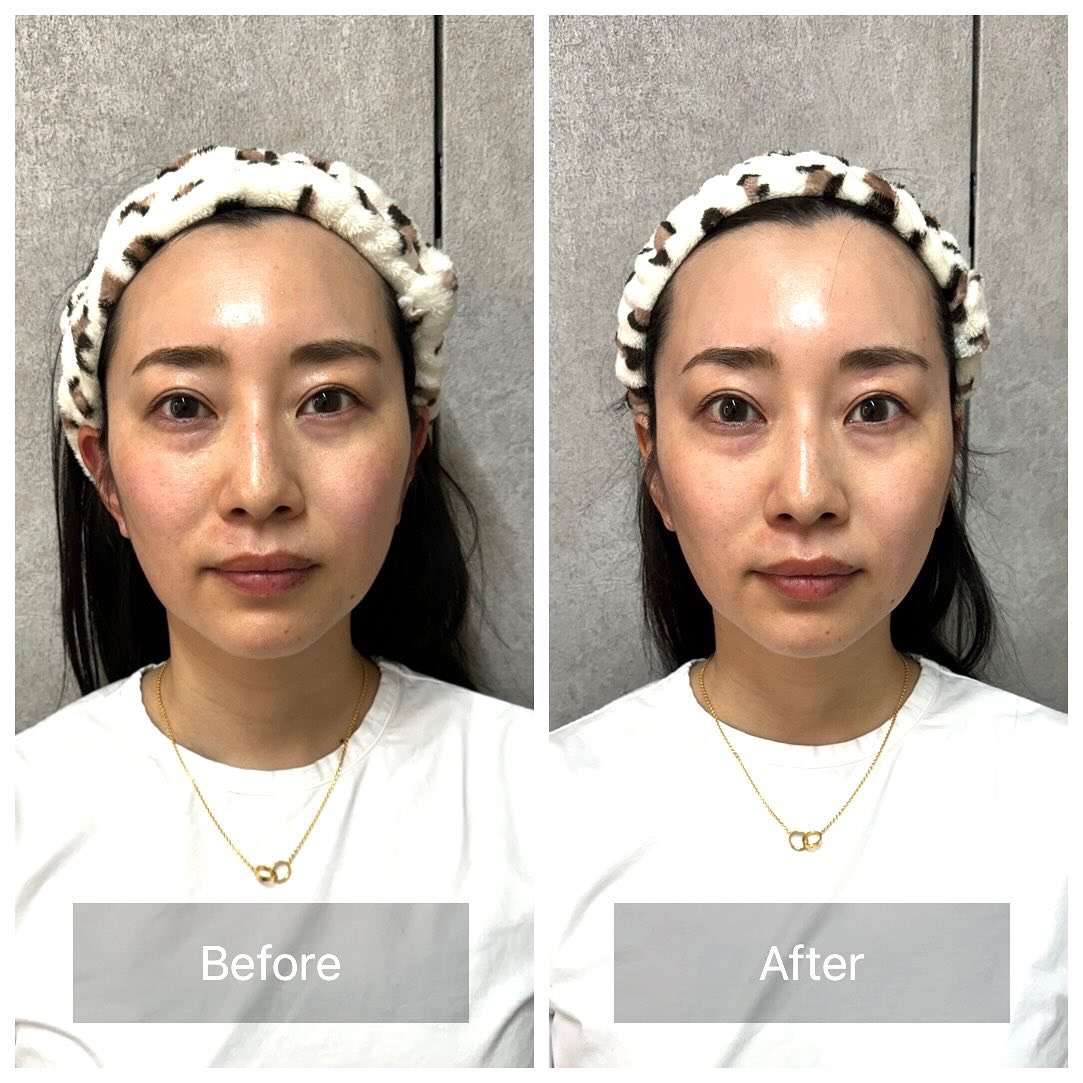 お肌のお悩み解消！