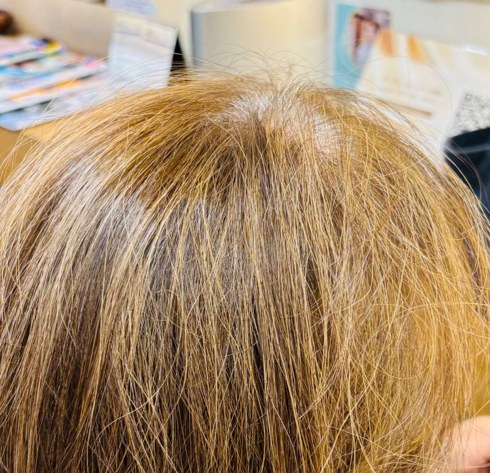 白髪が気になる方へ